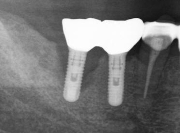 当院来院時のレントゲン