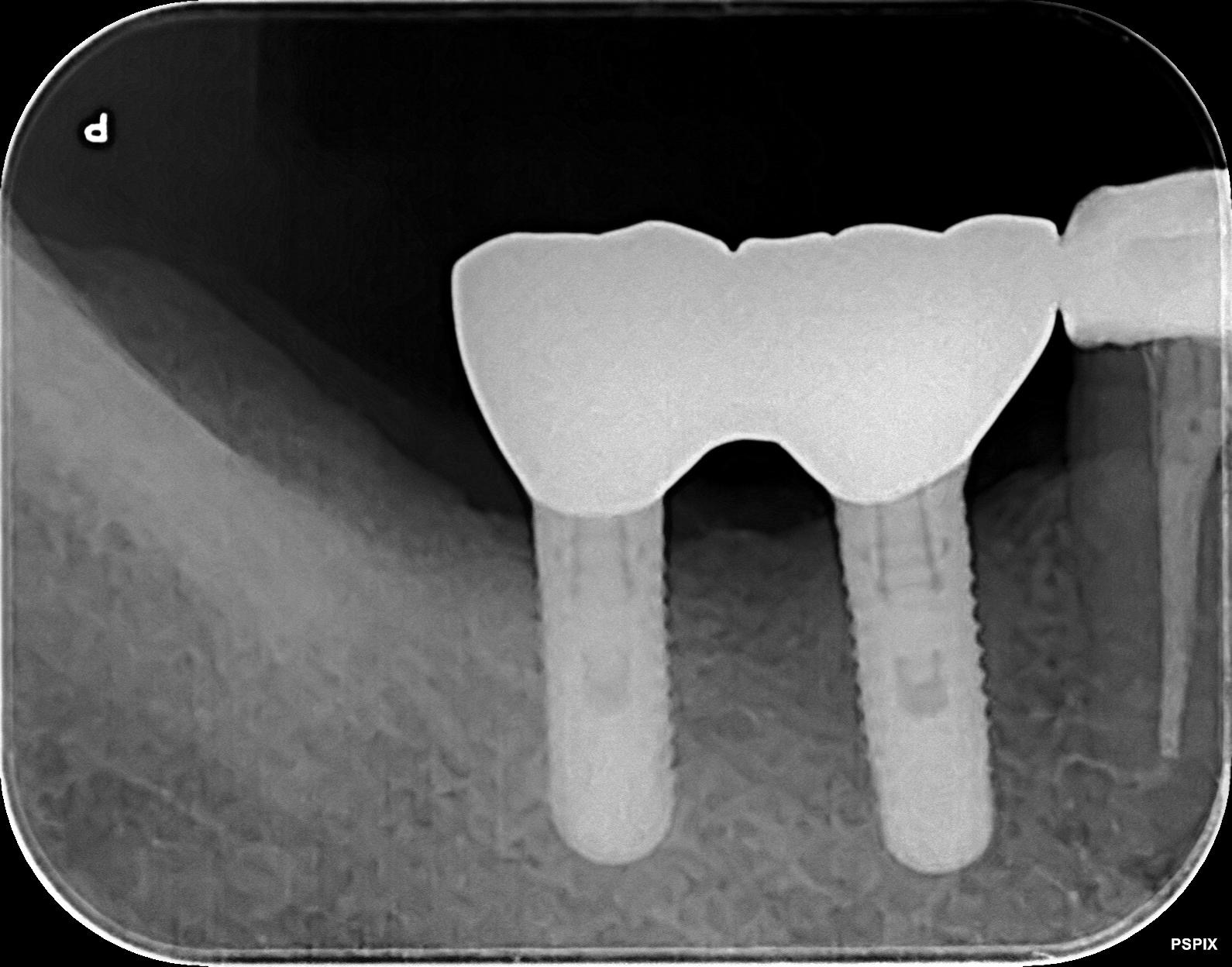 現在の健康な状態のレントゲン